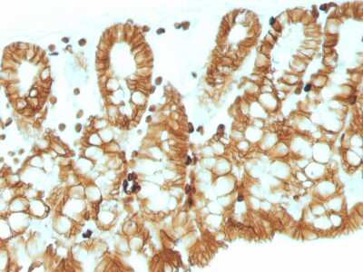 Immunohistochemistry-Paraffin: EpCAM/TROP1 Antibody (EGP40/1110) - (ECD) [NBP2-44635]