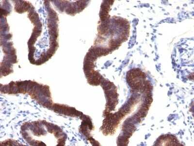 Immunohistochemistry-Paraffin: EpCAM/TROP1 Antibody (EGP40/1120) - (ECD) [NBP2-44636]