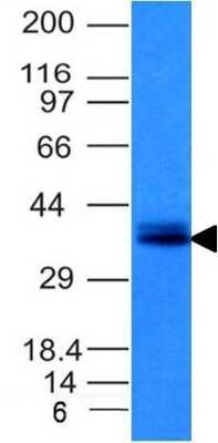 Western Blot: EpCAM/TROP1 Antibody (EGP40/1120)(ECD) [NBP2-44636]