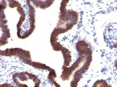 Immunohistochemistry-Paraffin: EpCAM/TROP1 Antibody (EGP40/1120) - (ECD) - IHC-Prediluted [NBP2-48265]