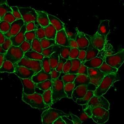 Immunocytochemistry/ Immunofluorescence: EpCAM/TROP1 Antibody (EGP40/1372) - (ECD) - Azide and BSA Free [NBP2-54419]