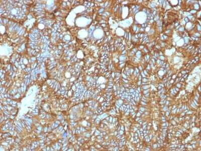 Immunohistochemistry-Paraffin: EpCAM/TROP1 Antibody (EGP40/1372) - (ECD) - Azide and BSA Free [NBP2-54419]