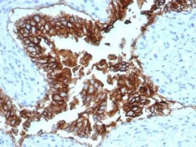 Immunohistochemistry-Paraffin: EpCAM/TROP1 Antibody (EGP40/1372) - (ECD) - Azide and BSA Free [NBP2-54419]