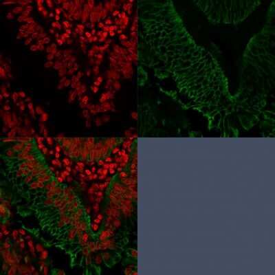 Immunocytochemistry/ Immunofluorescence: EpCAM/TROP1 Antibody (EGP40/1372) - (ECD) [NBP2-53264]