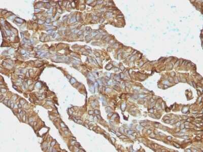 Immunohistochemistry-Paraffin: EpCAM/TROP1 Antibody (EGP40/1372) - (ECD) [NBP2-53264]