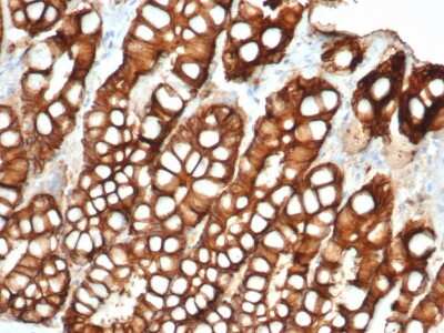 Immunohistochemistry-Paraffin: EpCAM/TROP1 Antibody (EGP40/1372) - (ECD) [NBP2-53264]