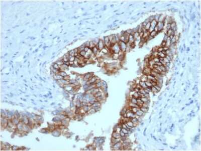 Immunohistochemistry-Paraffin: EpCAM/TROP1 Antibody (EGP40/1373) - (ECD) [NBP2-53277]