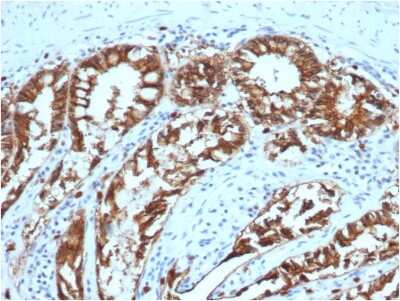Immunohistochemistry-Paraffin: EpCAM/TROP1 Antibody (EGP40/1373) - (ECD) [NBP2-53277]