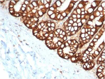 Immunohistochemistry-Paraffin: EpCAM/TROP1 Antibody (EGP40/1373) - (ECD) [NBP2-53277]