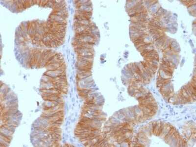Immunohistochemistry-Paraffin: EpCAM/TROP1 Antibody (EGP40/1384) - (ECD) - Azide and BSA Free [NBP2-54333]