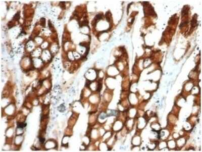 Immunohistochemistry-Paraffin: EpCAM/TROP1 Antibody (EGP40/1384) - (ECD) - Azide and BSA Free [NBP2-54333]