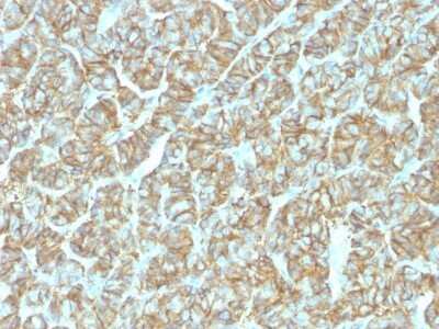 Immunohistochemistry-Paraffin: EpCAM/TROP1 Antibody (EGP40/1555R) - (ECD) - Azide and BSA Free [NBP2-54424]