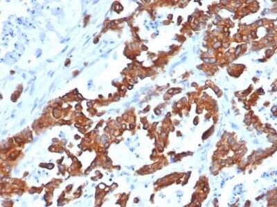 Immunohistochemistry-Paraffin: EpCAM/TROP1 Antibody (EGP40/1555R) - (ECD) [NBP2-53370]