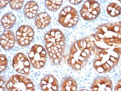 Immunohistochemistry-Paraffin: EpCAM/TROP1 Antibody (EGP40/1555R) - (ECD) [NBP2-53370]