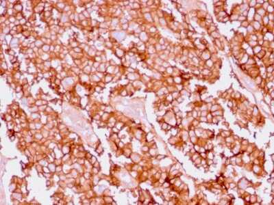 Immunohistochemistry-Paraffin: EpCAM/TROP1 Antibody (EGP40/1556R) - (ECD) [NBP2-53266]