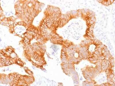 Immunohistochemistry-Paraffin: EpCAM/TROP1 Antibody (EGP40/1798) - (ECD) - Azide and BSA Free [NBP2-54456]