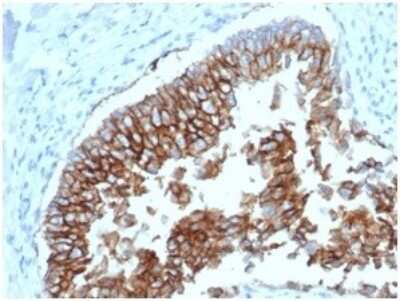 Immunohistochemistry-Paraffin: EpCAM/TROP1 Antibody (EGP40/1798) - (ECD) [NBP2-53213]