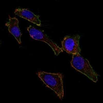 Immunocytochemistry/ Immunofluorescence: EpCAM/TROP1 Antibody (EGP40/826) - Azide and BSA Free [NBP2-47876]