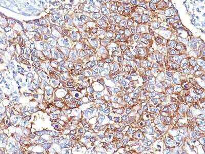 Immunohistochemistry: EpCAM/TROP1 Antibody (EGP40/826) - IHC-Prediluted [NBP2-48288]