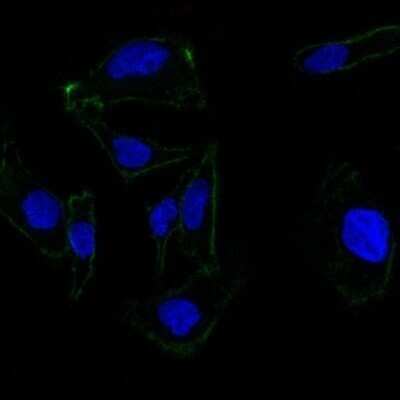 Immunocytochemistry/ Immunofluorescence: EpCAM/TROP1 Antibody (EGP40/837) - (ECD) - Azide and BSA Free [NBP2-47877]