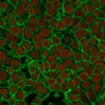 Immunocytochemistry/ Immunofluorescence: EpCAM/TROP1 Antibody (EGP40/837) - (ECD) - Azide and BSA Free [NBP2-47877]