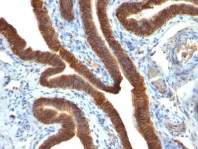 Immunohistochemistry-Paraffin: EpCAM/TROP1 Antibody (EGP40/837) - (ECD) - Azide and BSA Free [NBP2-47877]