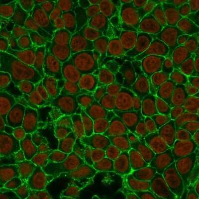 Immunocytochemistry/ Immunofluorescence: EpCAM/TROP1 Antibody (EGP40/837) - (ECD) [NBP2-44644]