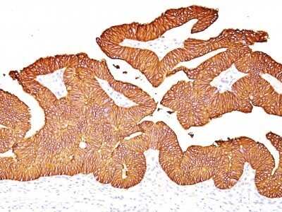 Immunohistochemistry-Paraffin: EpCAM/TROP1 Antibody (EGP40/837) - (ECD) [NBP2-44644]