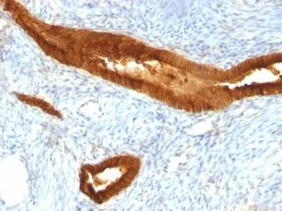 Immunohistochemistry-Paraffin: EpCAM/TROP1 Antibody (EGP40/837) - (ECD) [NBP2-44644]