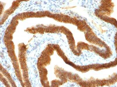 Immunohistochemistry-Paraffin: EpCAM/TROP1 Antibody (MOC-31) - IHC-Prediluted [NBP2-48287]