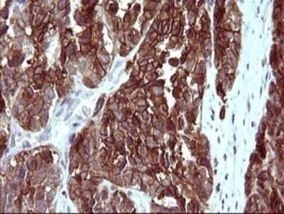 Immunohistochemistry: EpCAM/TROP1 Antibody (OTI1H9) - Azide and BSA Free [NBP2-71194]