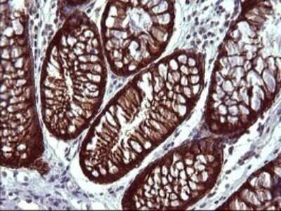 Immunohistochemistry: EpCAM/TROP1 Antibody (OTI1H9) - Azide and BSA Free [NBP2-71194]