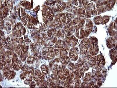Immunohistochemistry: EpCAM/TROP1 Antibody (OTI1H9) - Azide and BSA Free [NBP2-71194]