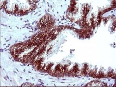 Immunohistochemistry: EpCAM/TROP1 Antibody (OTI1H9) - Azide and BSA Free [NBP2-71194]