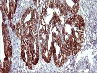 Immunohistochemistry: EpCAM/TROP1 Antibody (OTI1H9) [NBP2-45448]