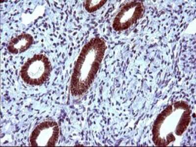 Immunohistochemistry: EpCAM/TROP1 Antibody (OTI1H9) [NBP2-45448]