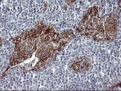 Immunohistochemistry: EpCAM/TROP1 Antibody (OTI1H9) [NBP2-45448]