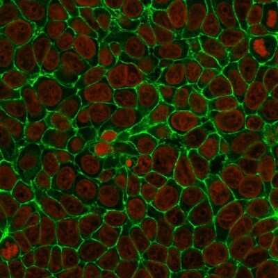 Immunocytochemistry/ Immunofluorescence: EpCAM/TROP1 Antibody (SPM134) - (ECD) [NBP2-34350]