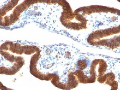 Immunohistochemistry-Paraffin: EpCAM/TROP1 Antibody (SPM134) - (ECD) [NBP2-34350]