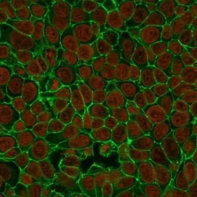 Immunocytochemistry/ Immunofluorescence: EpCAM/TROP1 Antibody (VU-1D9) - Azide and BSA Free [NBP2-33078]