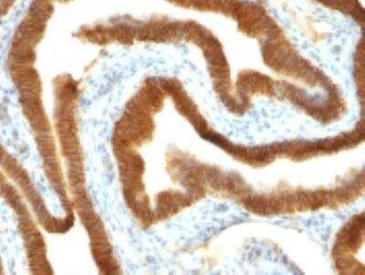 Immunohistochemistry-Paraffin: EpCAM/TROP1 Antibody (VU-1D9) - Azide and BSA Free [NBP2-33078]