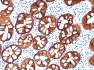 Immunohistochemistry-Paraffin: EpCAM/TROP1 Antibody (rMOC-31) - Azide and BSA Free [NBP2-54521]