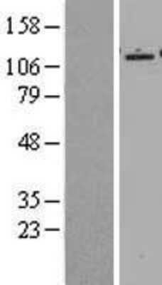 Western Blot: Epac2 Overexpression Lysate [NBL1-15153]