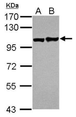 Western Blot: EphA1 Antibody [NBP2-16345]