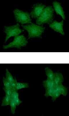 Immunocytochemistry/ Immunofluorescence: EphA2 Antibody (66G9) - BSA Free [NBP2-59479]