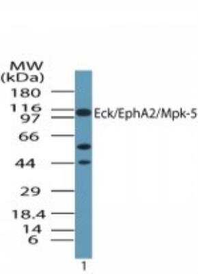 Western Blot: EphA2 Antibody [NBP2-24489]