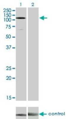 Western Blot: EphA3 Antibody (3A12) [H00002042-M01]