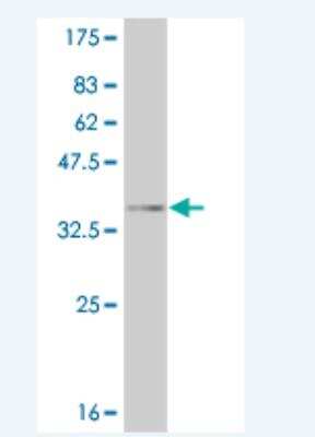 Western Blot: EphA4 Antibody (5A9) [H00002043-M03]