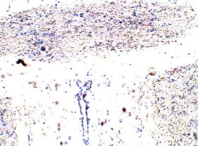 Immunohistochemistry-Paraffin: EphB1 Antibody [NBP3-12305]