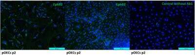 Immunocytochemistry/ Immunofluorescence: EphB2 Antibody (2D12C6) - BSA Free [NBP1-47525]